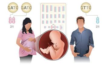 Trisomy