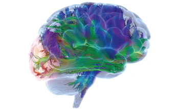 Brain HCP
