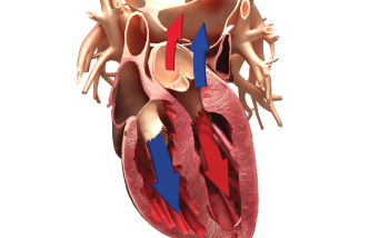 Cardiac Output